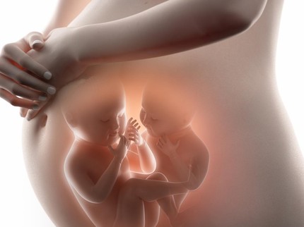Mengenal Program Bayi Kembar yang Bisa Dilakukan Secara Medis