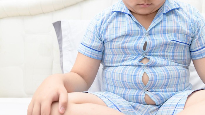 Ilustrasi Anak Obesitas