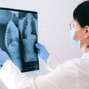 7 Kebiasaan Buruk yang Ternyata Bisa Merusak Tulang, Cek Kamu Suka Lakukan?