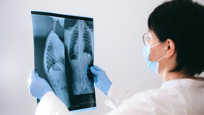 7 Kebiasaan Buruk yang Ternyata Bisa Merusak Tulang, Cek Kamu Suka Lakukan?