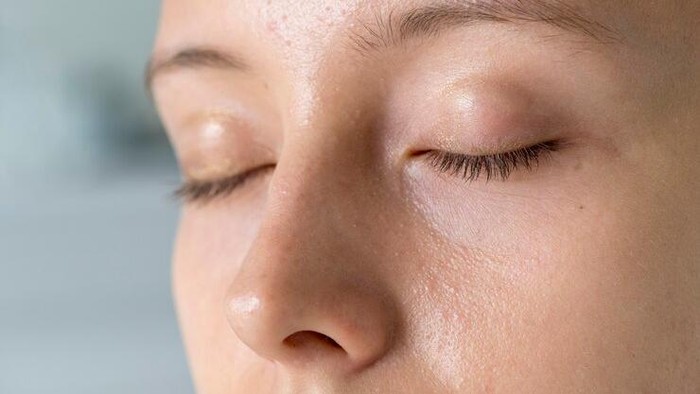 Penyebab Pori-Pori Besar di Wajah dan Cara Mengatasinya