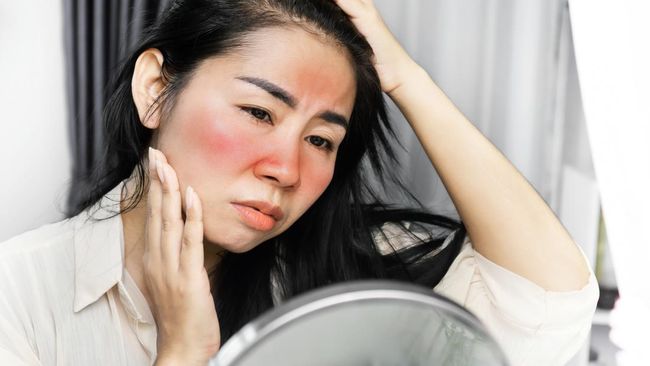 Kemerahan Pada Wajah Akibat Skincare