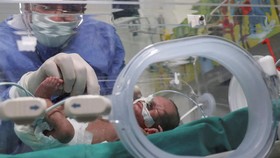 Bayi Prematur Lebih Rentan Alergi Susu Sapi, Ini Penyebabnya