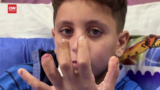 VIDEO: Anak-anak Palestina Butuh Tahunan untuk Hilangkan Trauma Perang