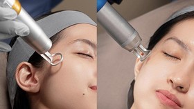 Shopee Finest Hadirkan Exclusive Launch Acneact Trial Kit dari ERHA