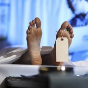 Viral Penemuan Mayat di Unpri Medan yang Ternyata Cadaver, Apa Itu?