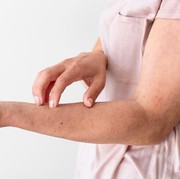 7 Tanda Diabetes yang Muncul di Kulit dan Jarang Disadari, Waspada!