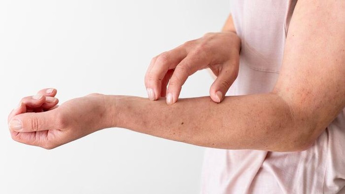 7 Tanda Diabetes yang Muncul di Kulit dan Jarang Disadari, Waspada!