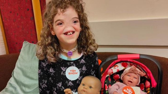 Terlahir Tanpa Hidung, Bocah Perempuan Ini Buktikan Setiap Orang Cantik dengan Caranya Sendiri