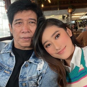 Parto Bongkar Cerita Amanda Caesa Pernah Pengin Jadi...