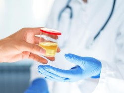 Sederet Warna Urine dan Artinya, Bisa Jadi Tanda Penyakit Serius