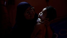 FOTO: Perjuangan Hidup Bocah Gagal Ginjal Akut Korban Obat Batuk Racun