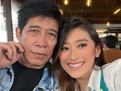 Cerita Lucu Parto dan Amanda Caesa saat Pilih-pilih Seragam untuk Lebaran