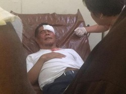 Kondisi Pj Gubernur Papua Usai Kena Lempar Batu Massa Antar Jenazah Enembe