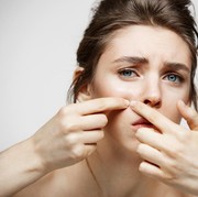 Cara Menghilangkan Milia di Sekitar Mata, Bisakah Menggunakan Skincare?