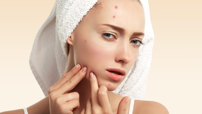 Kenali Purging pada Kulit dan Perbedaannya dengan Breakout