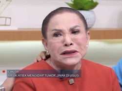 Puji Syukur Mpok Atiek usai Sembuh Total jadi Tumor Usus