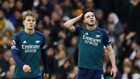 Arteta: Arsenal Tak Layak Menang