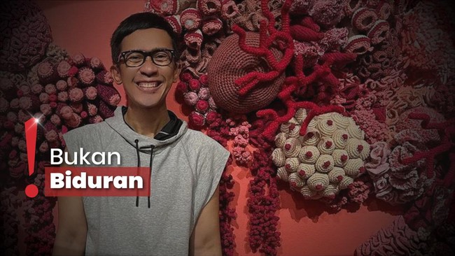 Tunjukkan Wajah Membengkak, Aming Ngaku Idap Sakit Autoimun