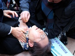 Insiden Horor Pria Misterius Tusuk Lee Jae Myung