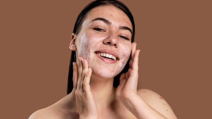 Amankah Double Cleansing untuk Pemilik Kulit Berjerawat? Ini Kata Dokter Kulit!