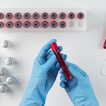 Golongan Darah P Ditemukan di China, Sangat Langka di Dunia