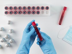 Golongan Darah P Ditemukan di China, Sangat Langka di Dunia