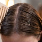 Jangan Dianggap Sepele, Ini 3 Cara Merawat Kesehatan Kulit Kepala