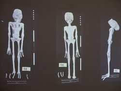 Kontroversi Mumi Alien di Peru, Sidik Jarinya Disebut Tak Cocok dengan Manusia