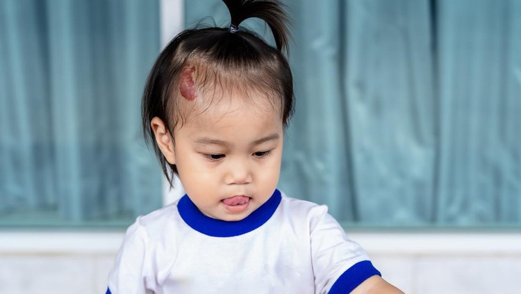Tanda Lahir Anak