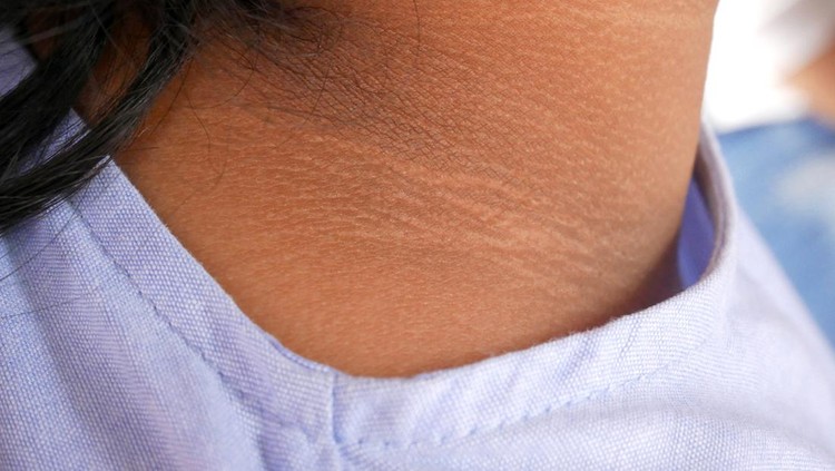Black neck skin texture close up.