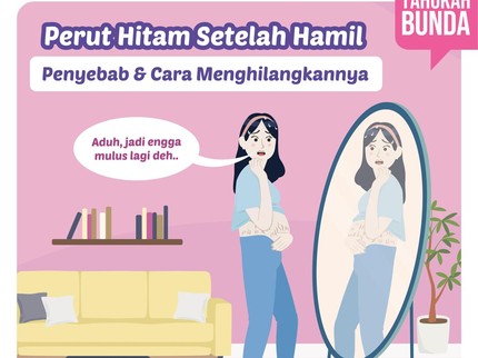 Perut Hitam setelah Hamil, Penyebab & Cara Menghilangkannya