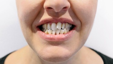 Arti Mimpi Gigi Bawah Copot Menurut Primbon Jawa