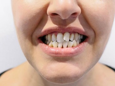 Arti Mimpi Gigi Bawah Copot Menurut Primbon Jawa