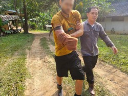 Digigit Beruang Saat Jadi Relawan, Pria Swiss Pilih Potong Tangan