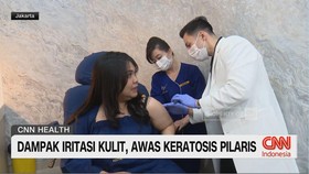 VIDEO: Dampak Iritasi Kulit, Awas Keratosis Pilaris