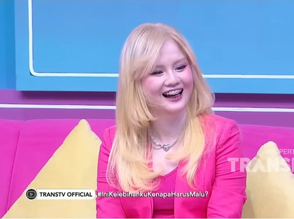 Kisah Anindhita Asmarani, Perempuan Albino asal Bekasi yang Viral karena Kepercayaan Dirinya