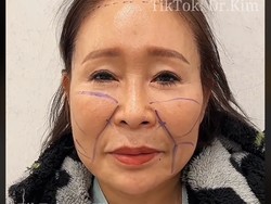 Modal Rp 781 Juta, Nenek-nenek Berubah Jadi Remaja