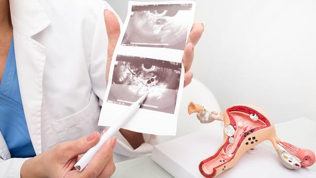 Kenali Gejala Awal Turun Peranakan Dan Penyebabnya, Ibu Hamil Hati-hati