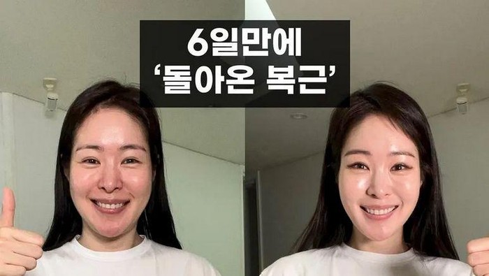 Viral Potret Transformasi Aktris Korea yang Turun 5 Kg dalam 6 Hari, Bikin 'Pangling'