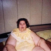 Ini Kisah Haru Rosalie Bradford, Perempuan Terberat di Dunia yang Sukses Turunkan Bobot 408 Kg!