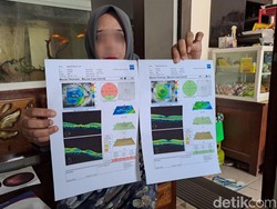Kronologi Saraf Retina Anak Polisi Jombang Rusak Kena Pecahan Gagang Sapu
