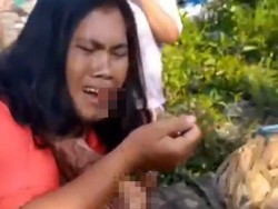Ibu di Medan Ngaku Dianiaya Polisi saat Nyusui Anak, Ditampar-Mulut Berdarah