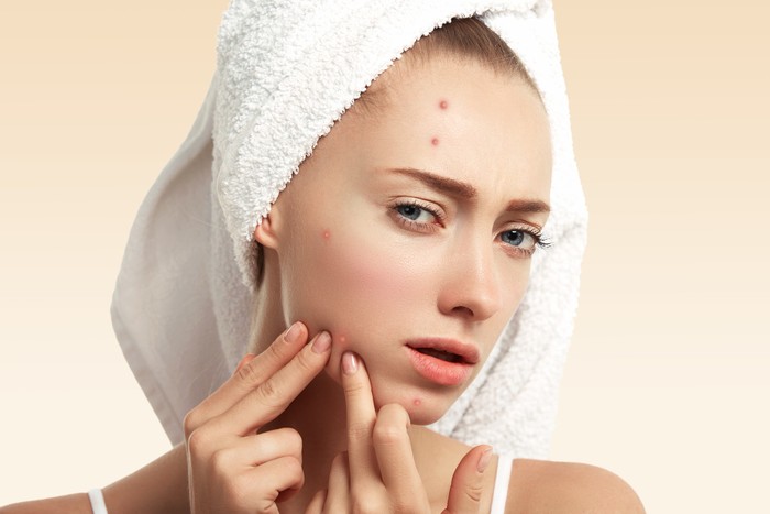 Acne Patch untuk Tutupi Jerawat Jadi Tren, Apa Manfaatnya?
