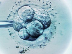 Putusan Pengadilan AS Anggap Embrio Beku adalah Bayi, Apa Dampaknya?