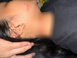 2 Pemotor Jatuh dan Terseret ke Trotoar gegara Tersangkut Kabel di Denpasar