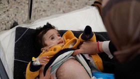FOTO: Pilu Anak-anak di Gaza Kelaparan hingga Meninggal Gegara Israel