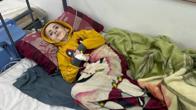 Komisaris Tinggi PBB untuk Hak Asasi Manusia, Volker Turk, mengatakan Israel berniat menggunakan kelaparan sebagai senjata perang di Jalur Gaza, Palestina.