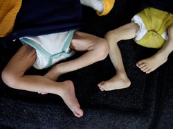 Nasib Pilu Anak-anak di Gaza: Tewas karena Bom atau Mati karena Kelaparan