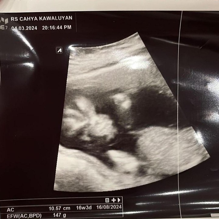 <p>Nadya membagikan potret USG kehamilan keduanya ini ke publik untuk pertama kali pada Jumat (8/3/24). Kehamilan kedua ini sudah masuk usia 16 minggu, Bunda. (Foto: Instagram @iqbalfitrahr/ @nadyamustikarahayu)</p>